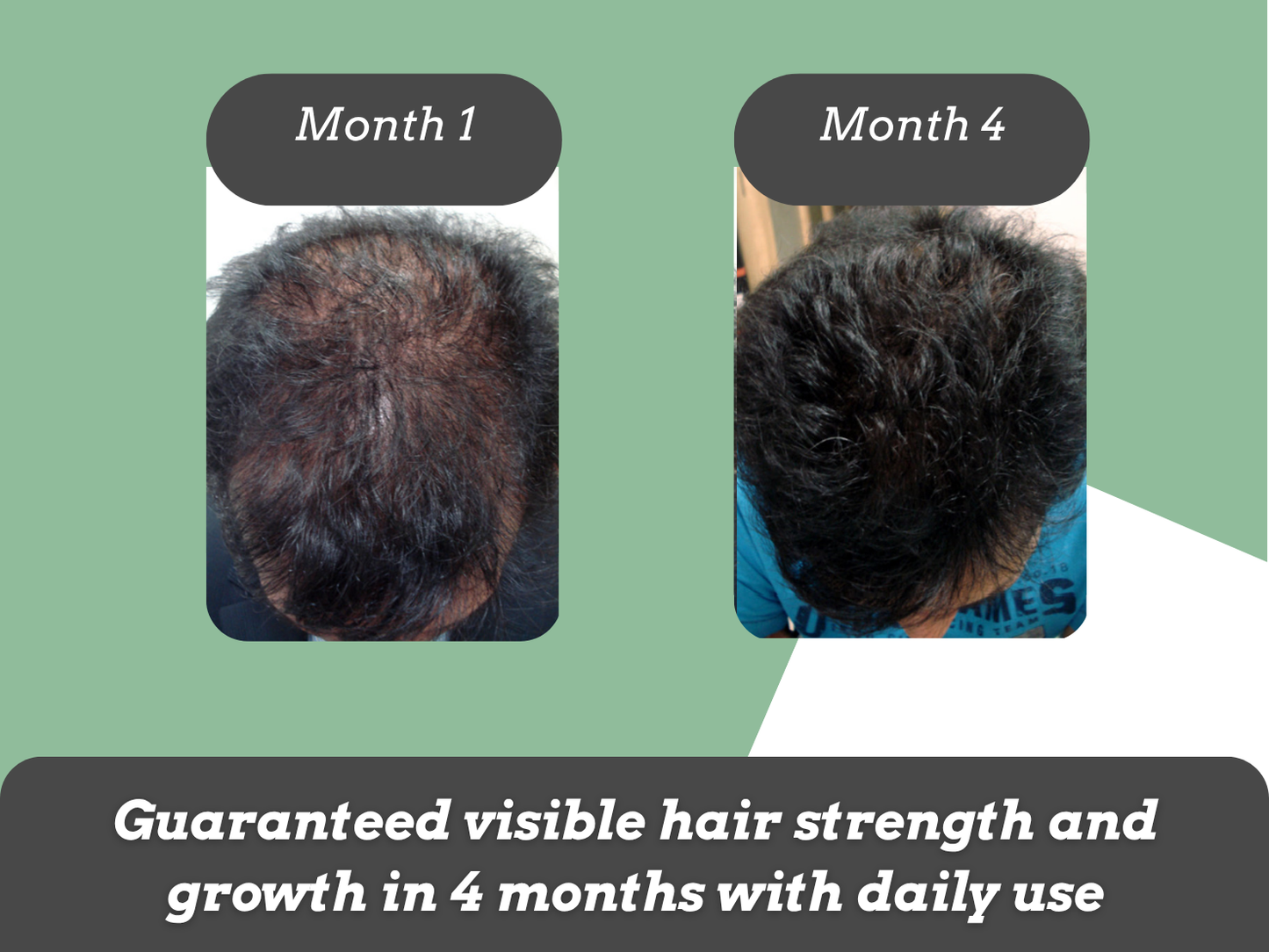 Zinc & Biotin Rich Superfood for Hair Growth - 30days pack
