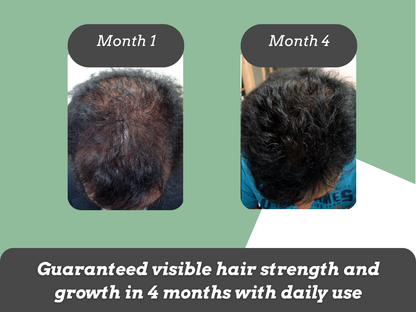 Zinc & Biotin Rich Superfood for Hair Growth - 60days pack
